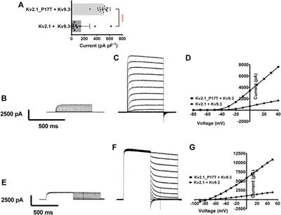 A KCNB1 gain of function variant causes developmental delay and speech apraxia but not seizures